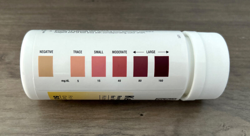 Urine test strips for diabetic ketoacidosis (DKA)