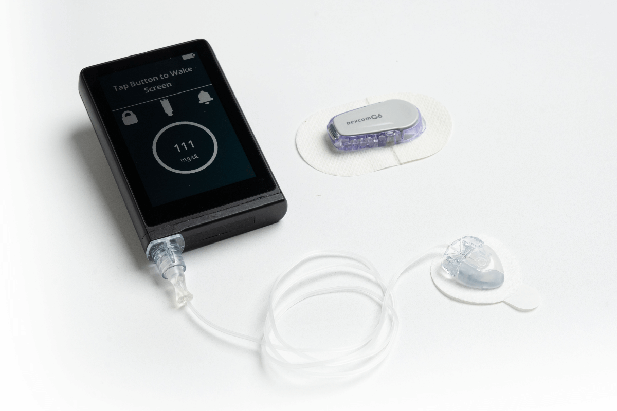 iLet Bionic Pancreas Automated Insulin Dosing with Dexcom Continuous Glucose Monitor